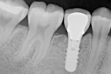 Adriane Paglia - Odontologia