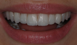 Adriane Paglia - Odontologia