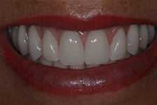 Adriane Paglia - Odontologia